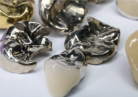 パラジウム、ホワイトゴールド、ピンクゴールド、イエローゴールドなど各種合金